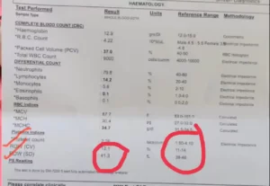 RDW blood test in Hindi। RDW टेस्ट क्या है? और क्यों किया जाता है? इसका सामान्य स्तर क्या है?
