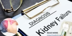 symptoms of kidney failure in hindi : किडनी फेल होने के 10 लक्षण ,कारण और बचाव क्या है?