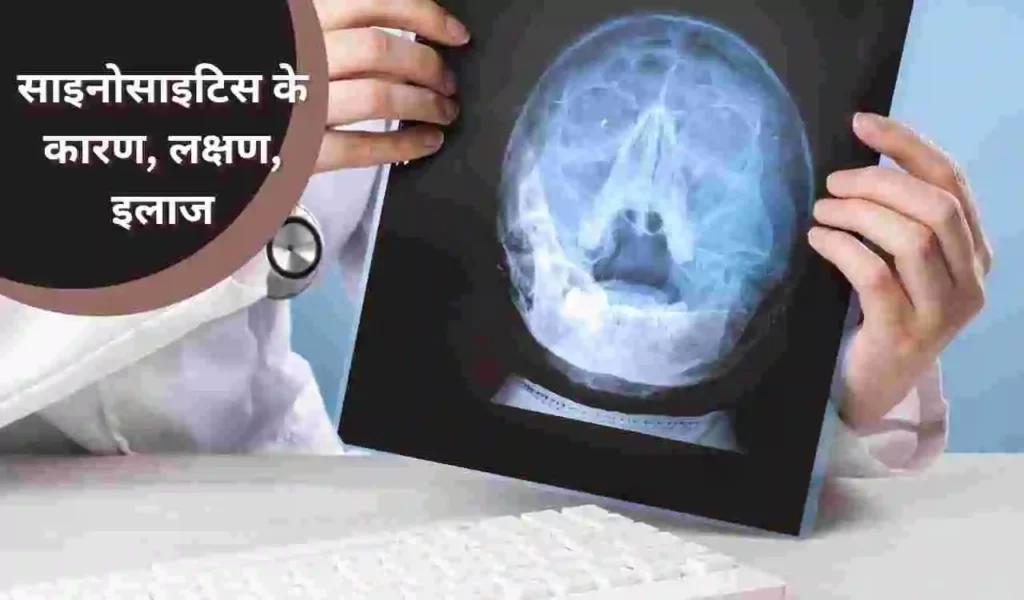 Sinusitis Treatment in Hindi