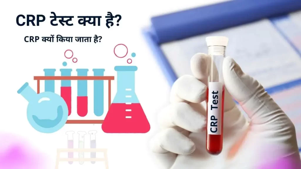 CRP test in Hindi : सीआरपी टेस्ट क्या है, क्यों किया जाता है? और इसका सामान्य स्तर क्या होता है?
