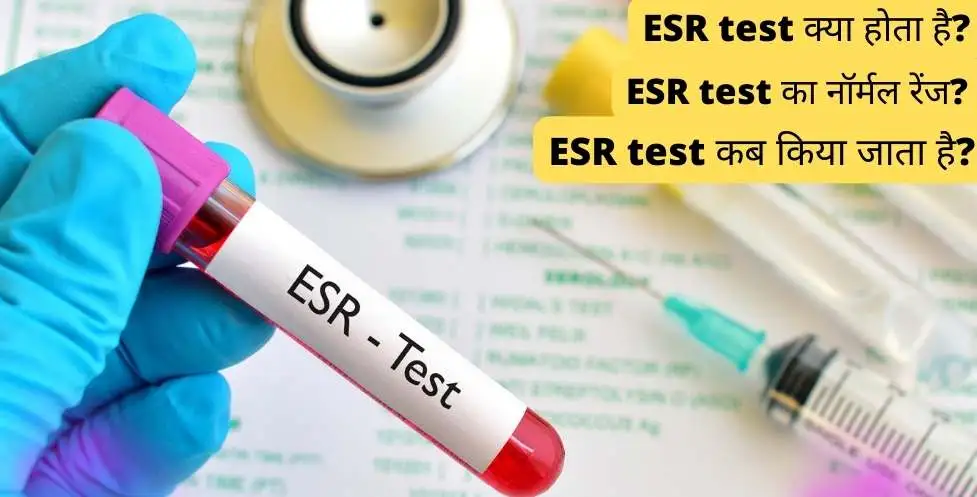 ESR test in Hindi | ESR level को कम करने के घरेलू उपाय? - medicin.org.in