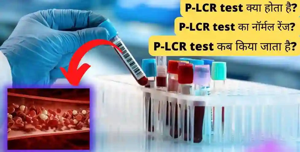 P-LCR test क्या होता है? जानिए स्वस्थ शरीर में कितनी होनी चाहिए P-LCR? | P-LCR क्यों किया जाता है