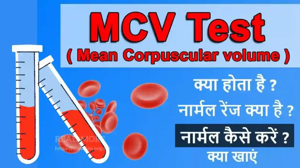 MCV Test in Hindi । एमसीवी टेस्ट की सम्पूर्ण जानकारी हिंदी में?