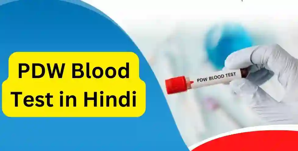 पीडीडब्ल्यू  ब्लड टेस्ट की सम्पूर्ण जानकारी | PDW Blood Test in Hindi?