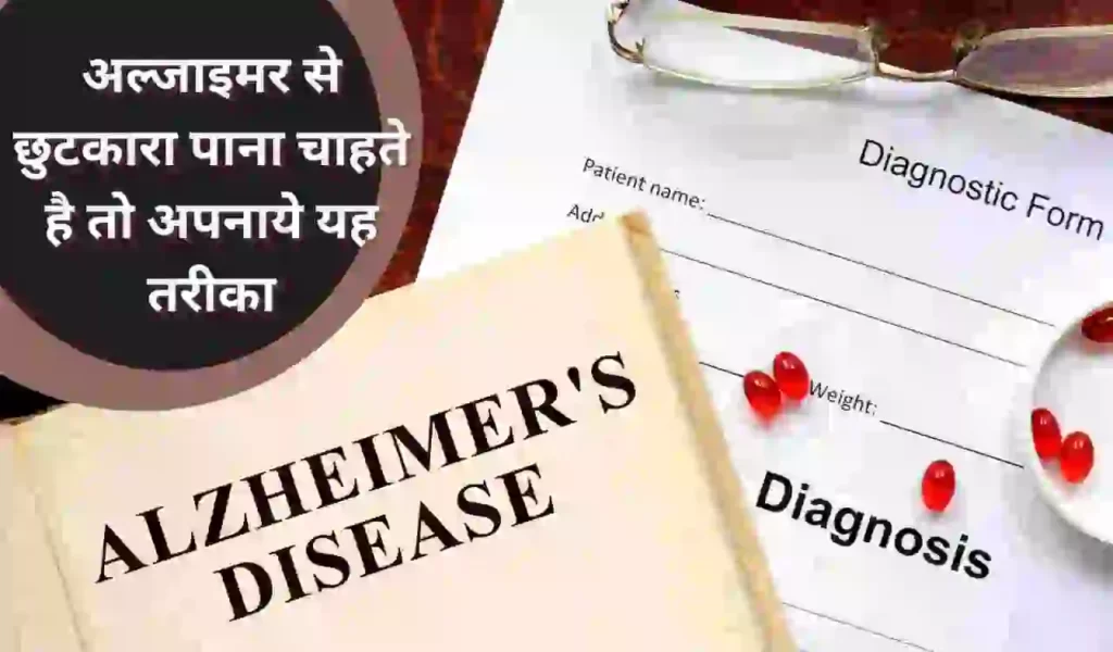 Alzheimer’s : अल्जाइमर से छुटकारा पाना चाहते है तो अपनाये यह तरीका